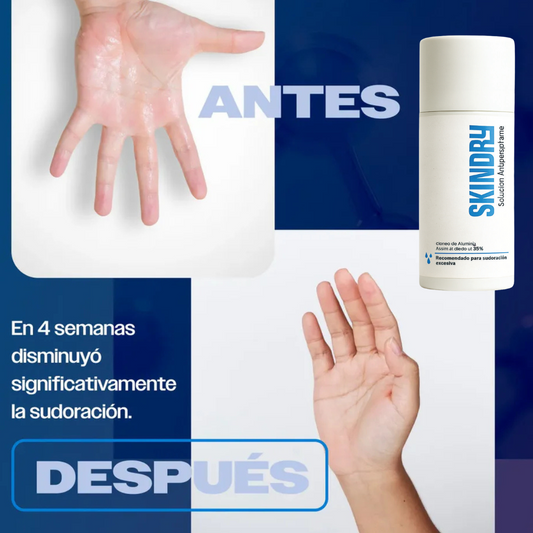 Skindry™ Solución Antitranspirante 120ml para sudoración excesiva en manos, axilas y pies 🎁 50% DCTO